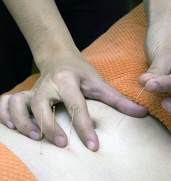 Cum ne ajuta homeopatia si acupunctura contra stresului